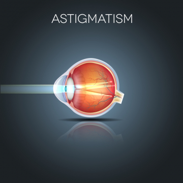 astigmatismul a încețoșat vederea)
